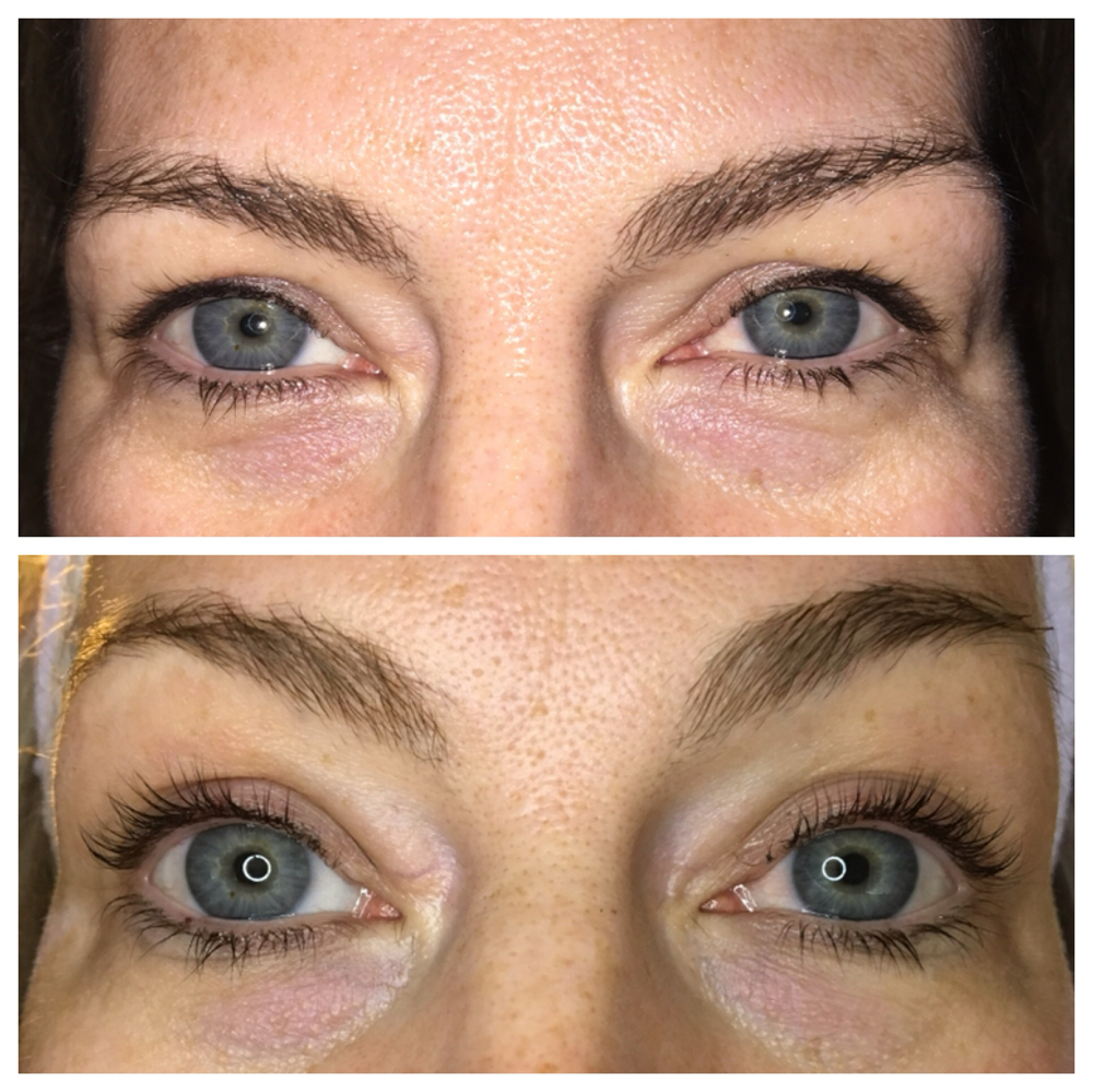 Lash Lift