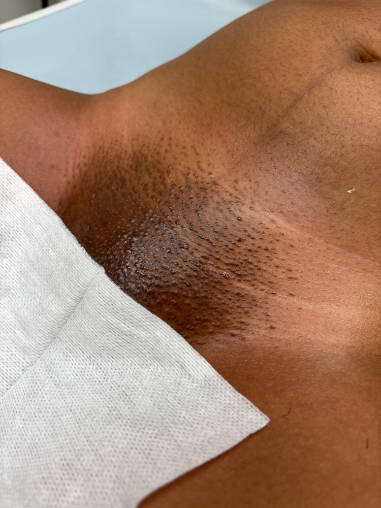 Bikini wax and relax