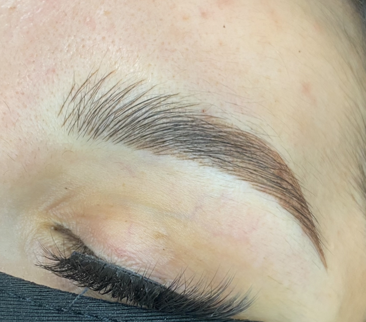 Combination Brow Yearly Follow Up