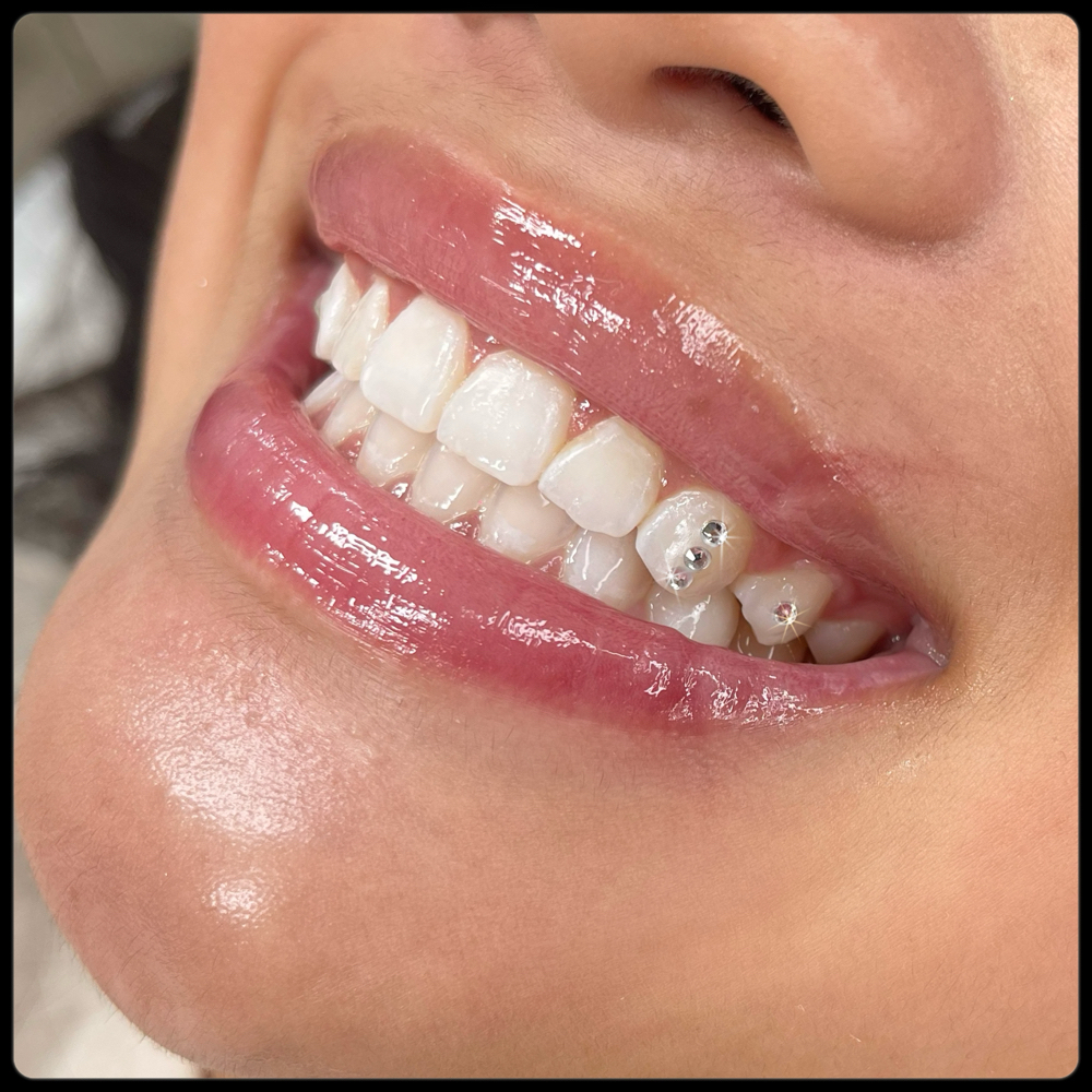 Tooth Gem Set