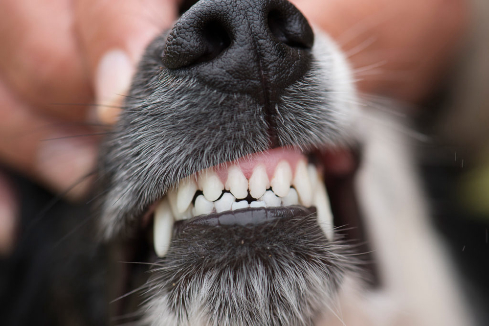Teeth Cleaning