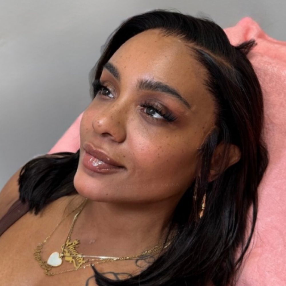 Smile Lines at Aesthetics by Amina in New York, NY