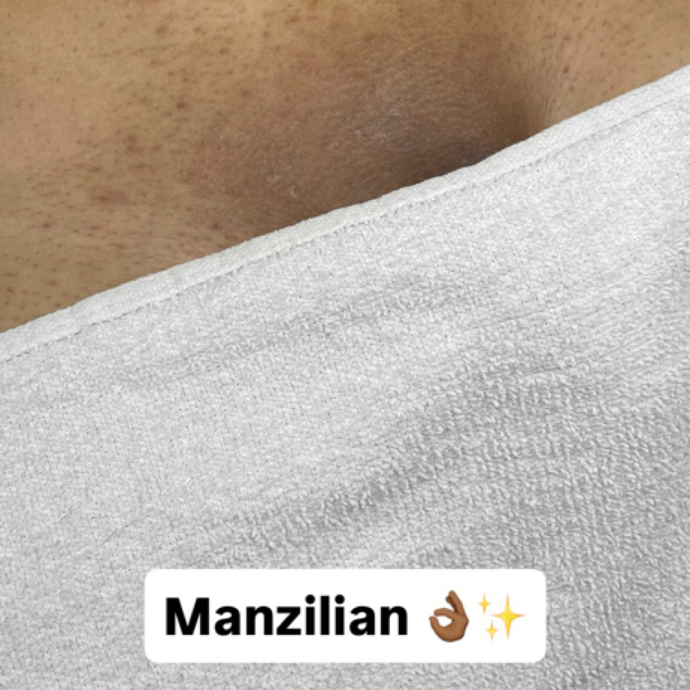 New Manzilian Client at Liv Beautiful Esthetics in CA, CA