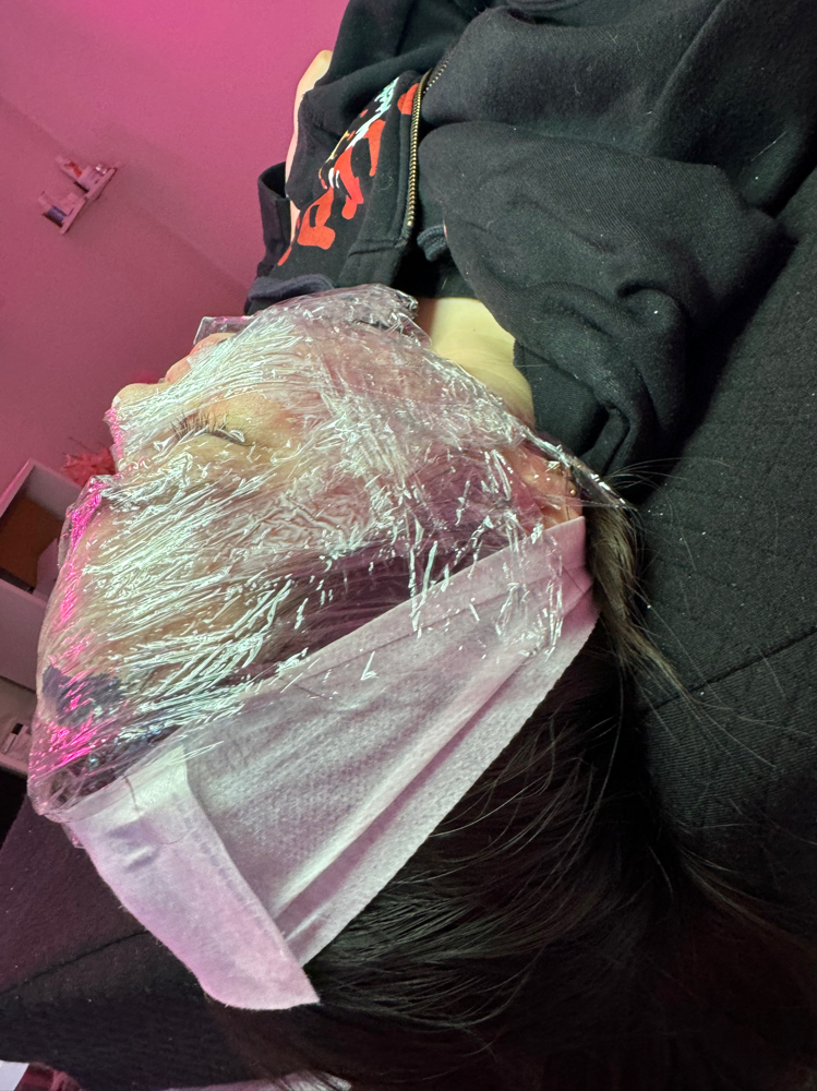 Microneedling + PRP Peel Combo