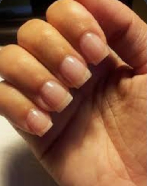 Acrylic Overlay
