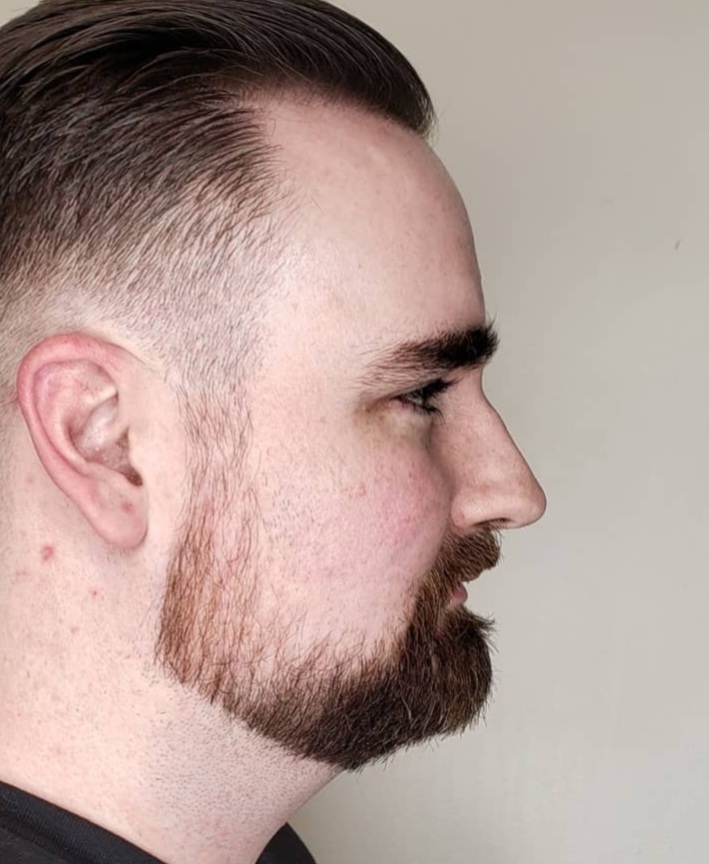 Beard Trim