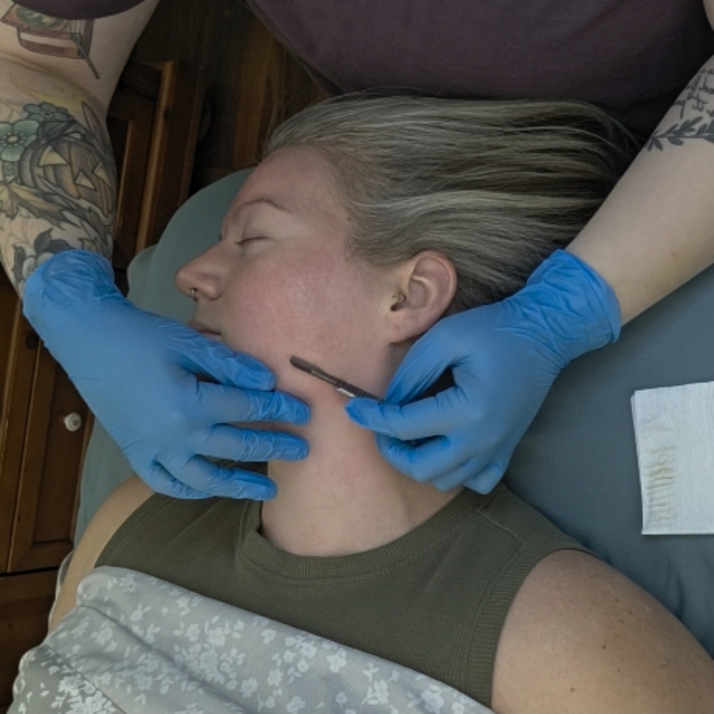 Dermaplane at TheraBloom Wellness in Liverpool, NY