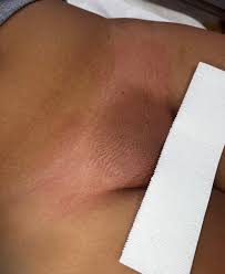 Brazilian Wax