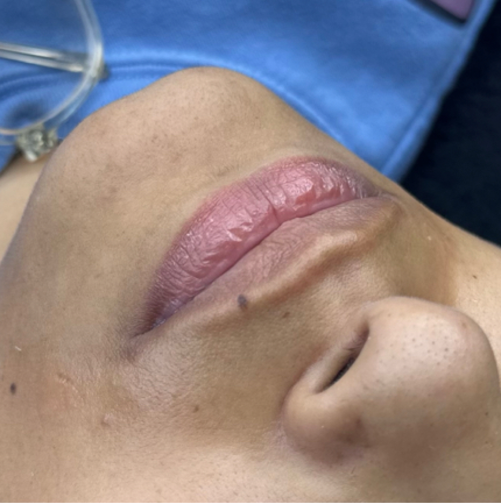 Chin Wax at Diverse Esthetics in Depew, NY