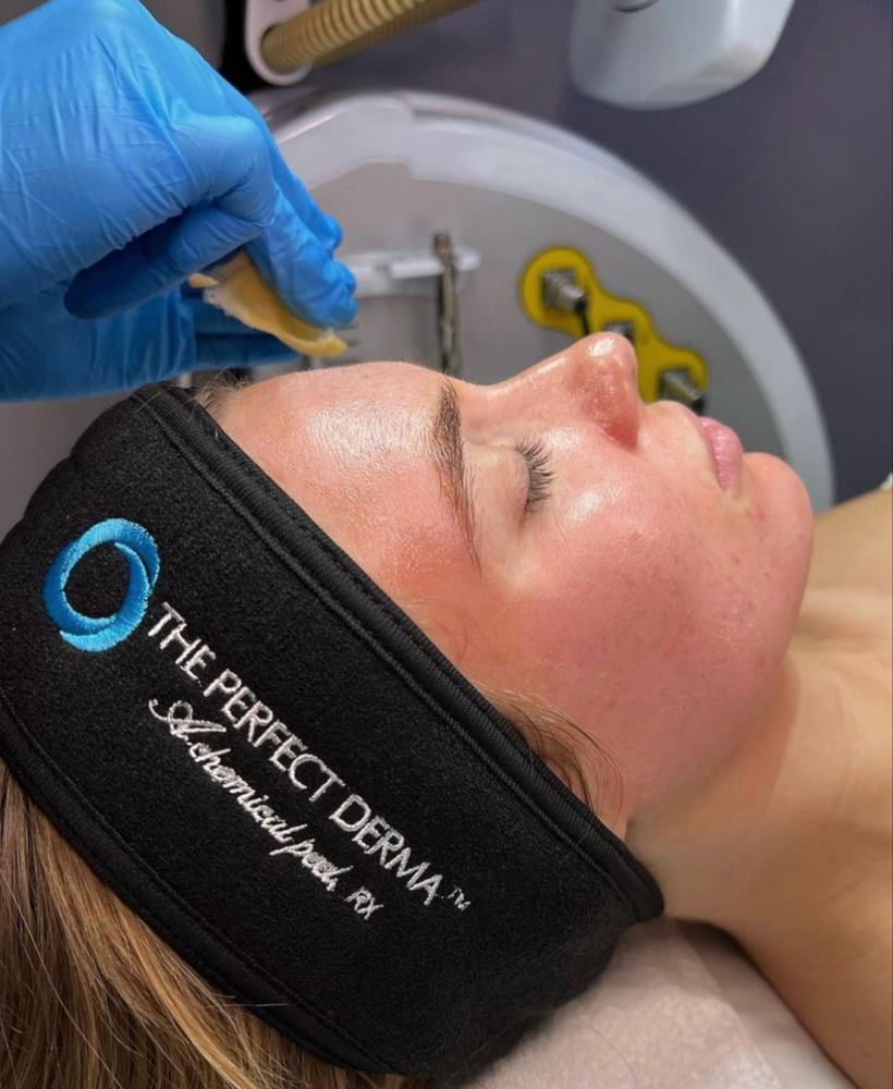 The Perfect Derma Peel