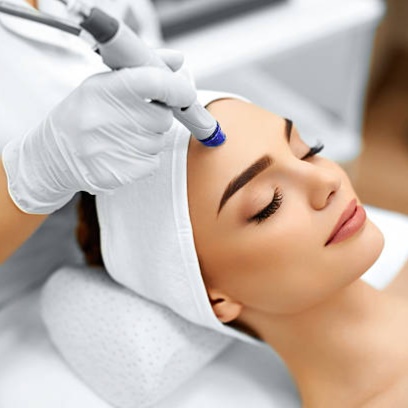 Microneedling — Full Face at Soluna Vee Spa in Colorado Springs, CO