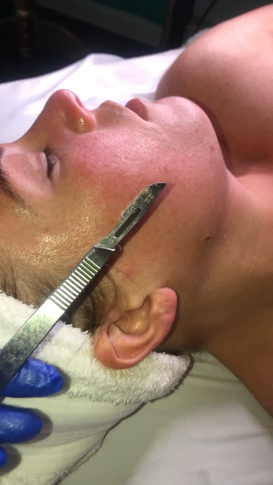 Free Of Fuzz (Dermaplaning Facial)