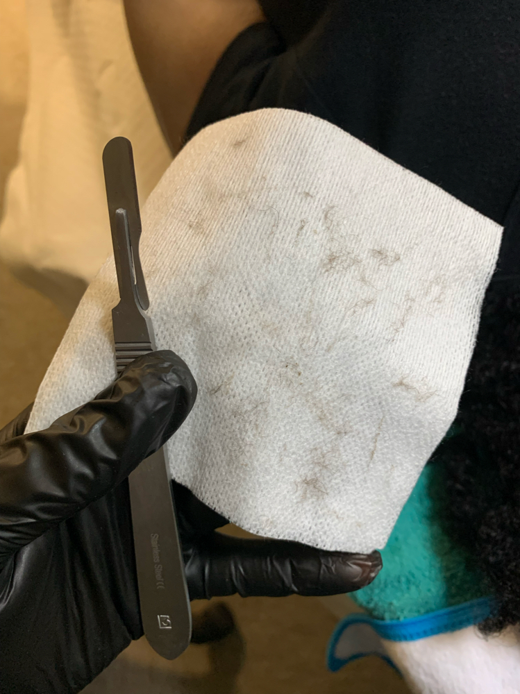 Dermaplane (add on facial service)