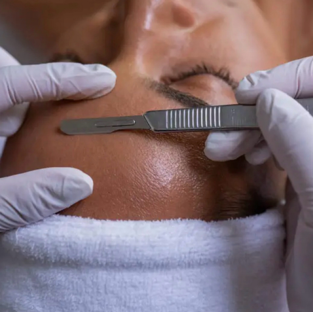Dermaplaning at Lush and Lifted, LLC