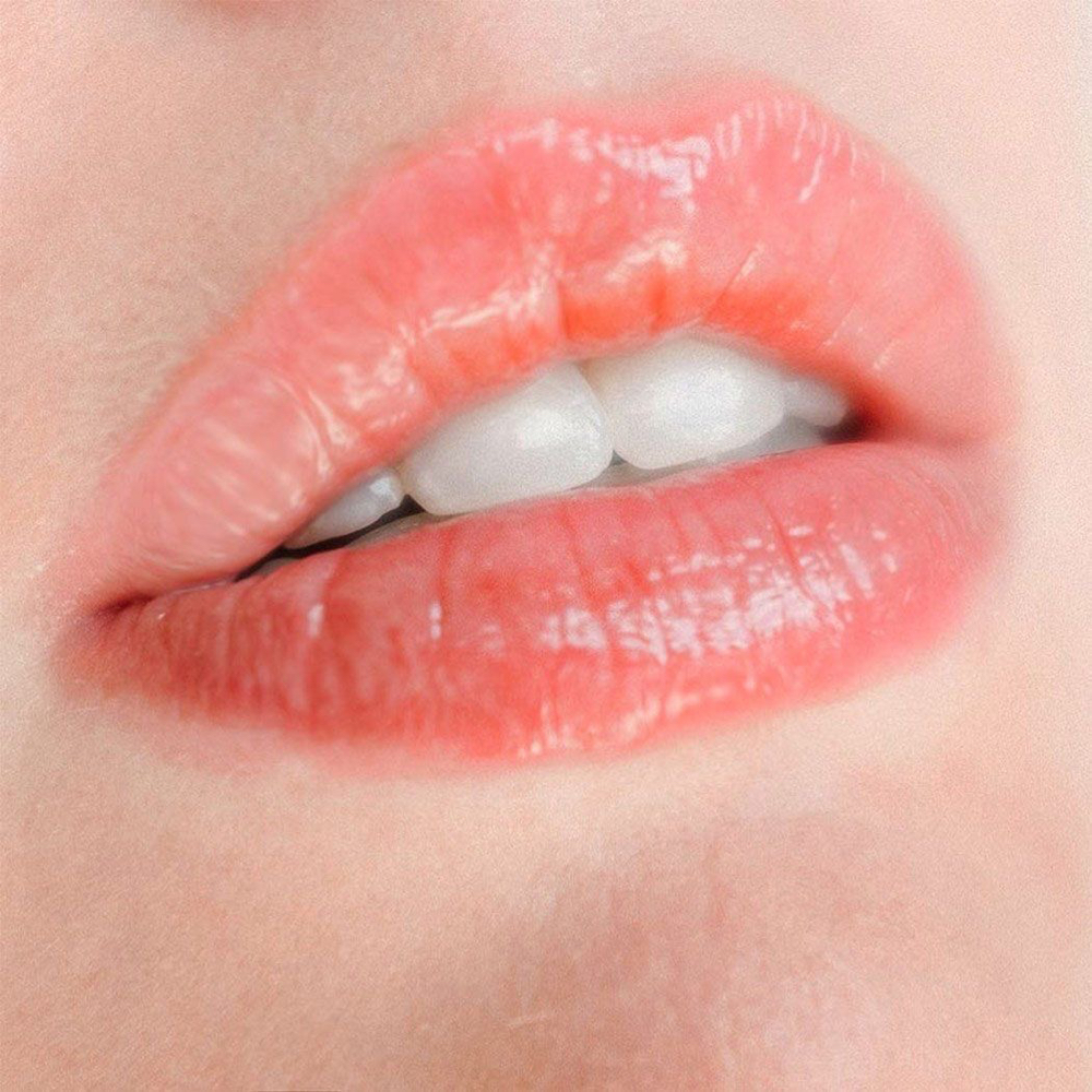 Lip Upgrade Add On
