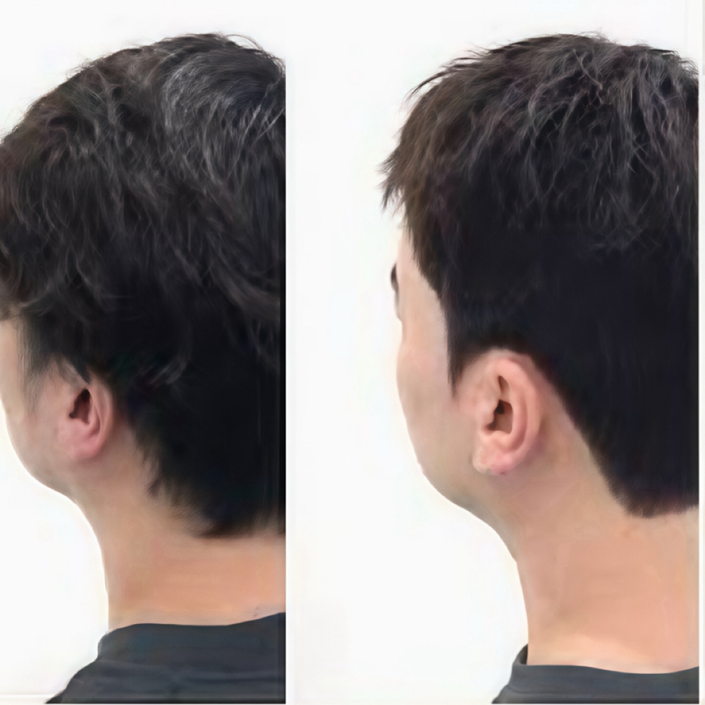 Partial Down PermAdd To Service60$