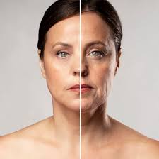 Age Defy