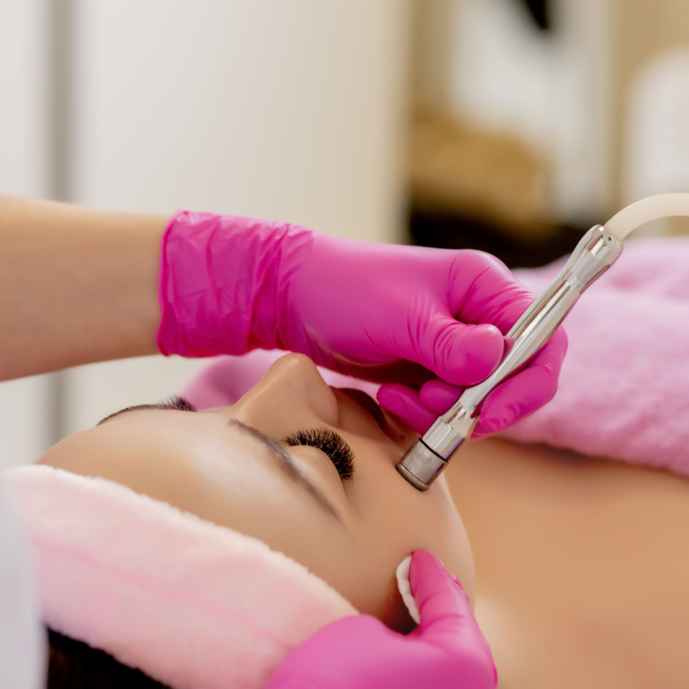 Microdermabrasion Facial