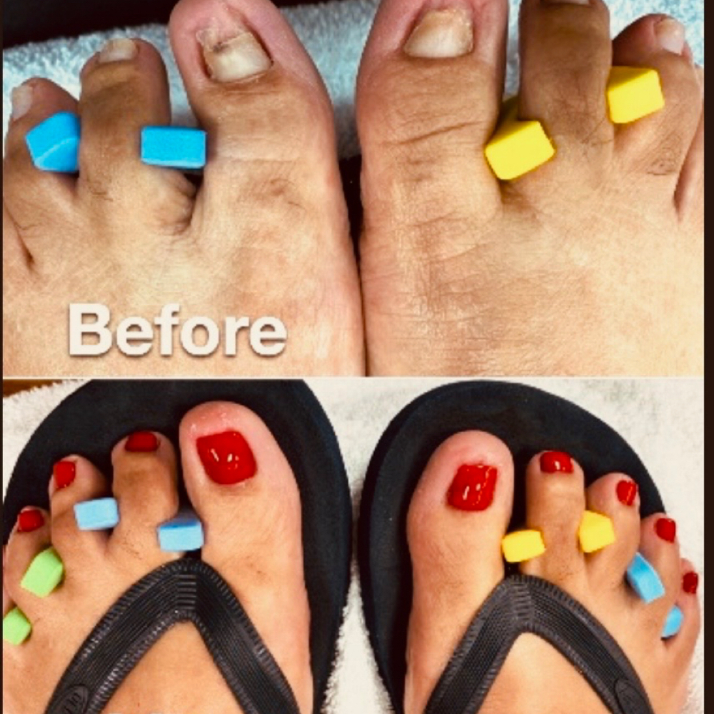 Un-Confident Feet Pedicure at Anointed Touch By Nijayia in Lillington, NC