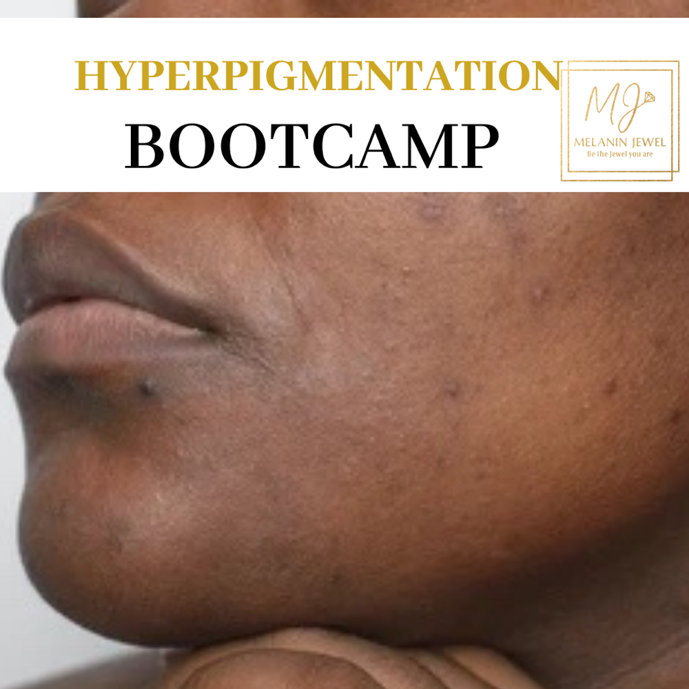 Hypigmentation Bootcamp