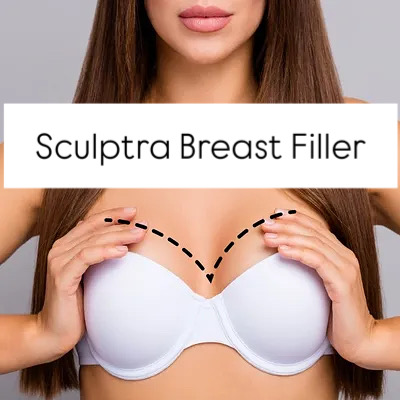 Sculptra Breast Filler