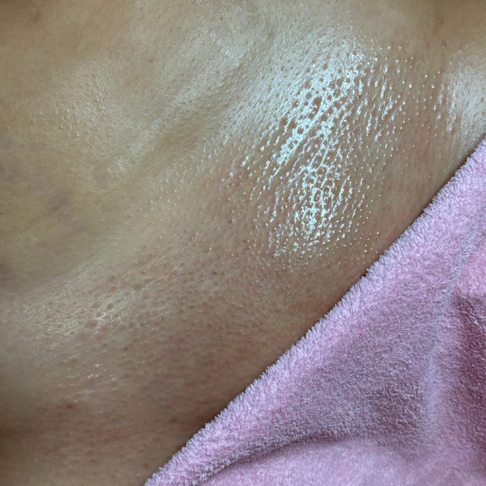 Brazilian Wax at Bare Beauty Esthetics in Springfield, TN