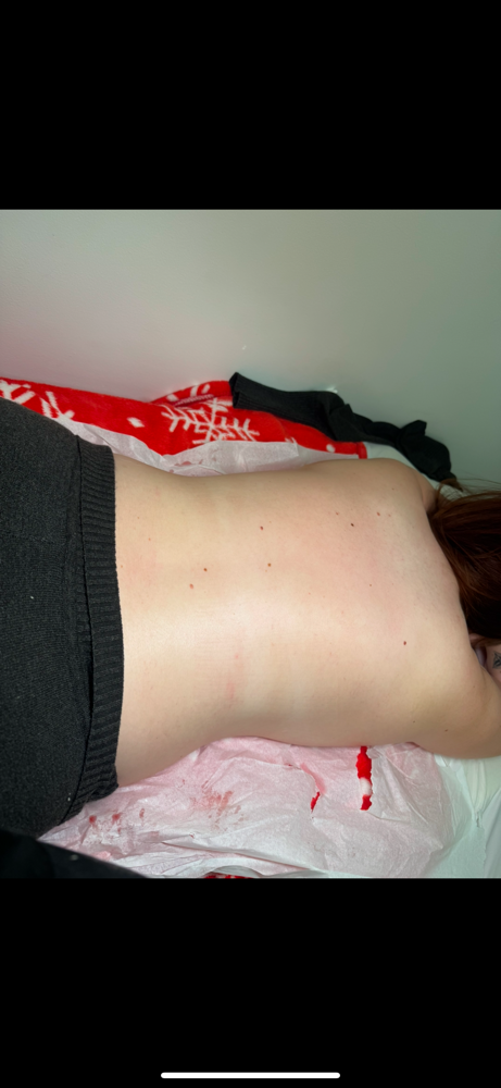 Back Treatment