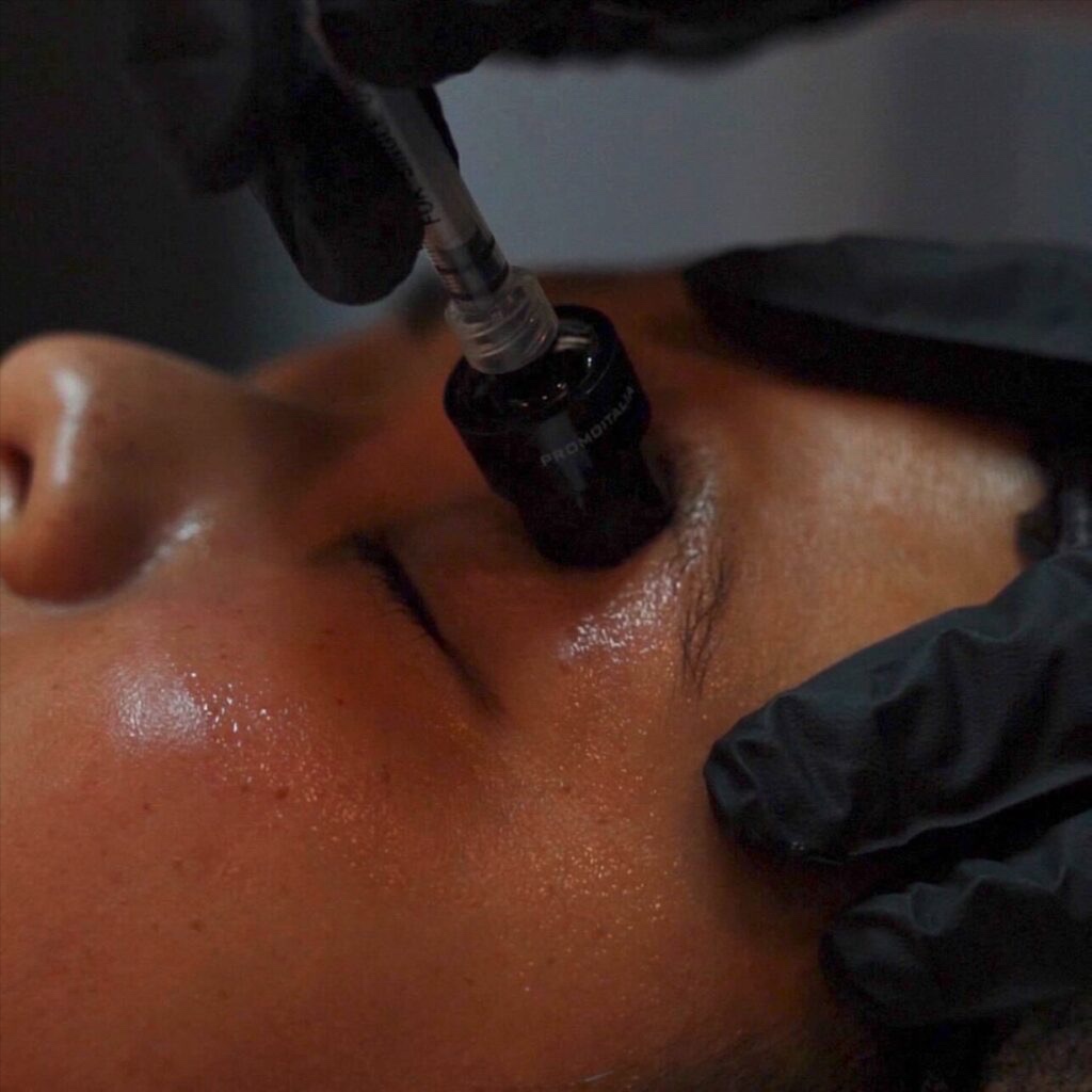Mermaid Facial at The Skin Concierge in Northbrook, IL