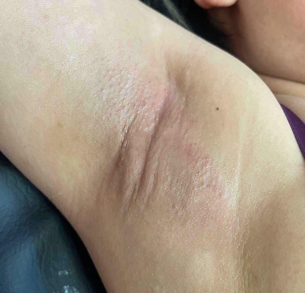 Underarm wax at THEESTHETICGLOW in Dallas, TX