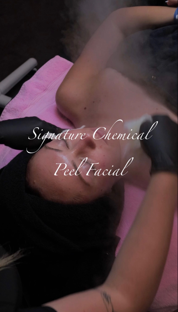 Sadies Signature w/ Chemical Peel