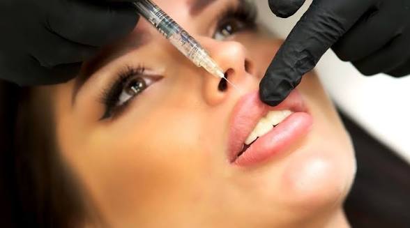Botox - Lip Lines at Natural Glow in Grand Praire, TX