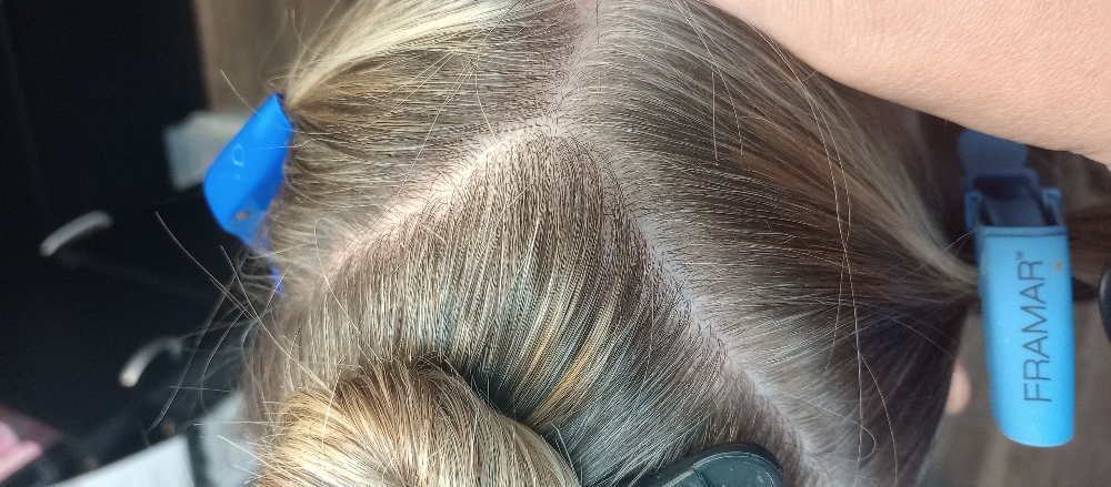 Scalp Rejuvenation