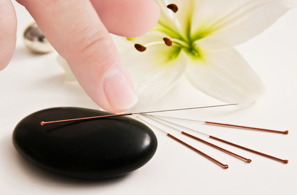 Acupuncture Treatment