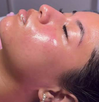 Pca Deluxe Facial Glow