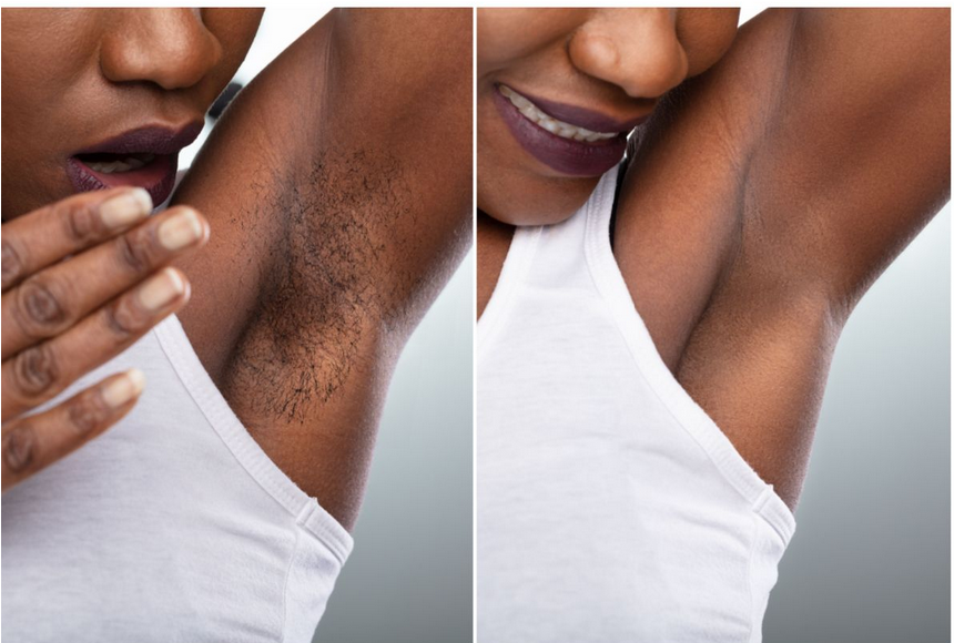 Underarm