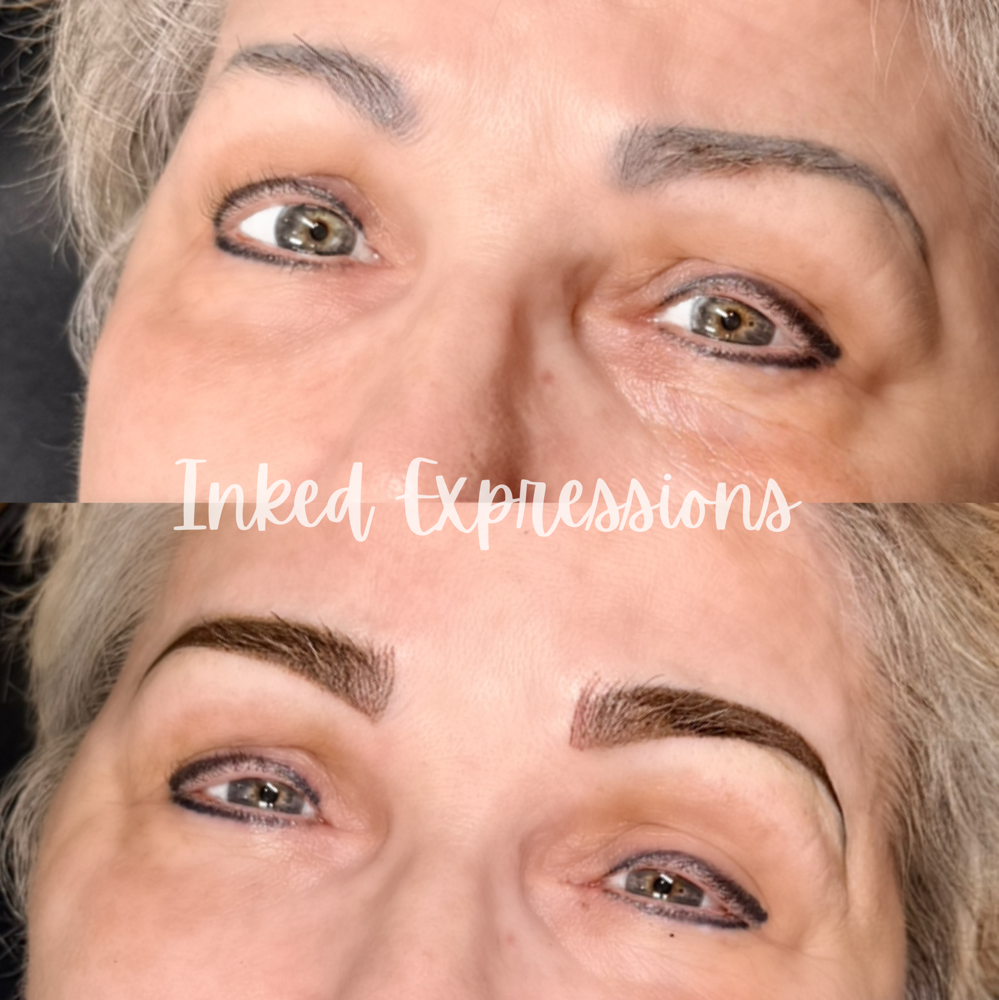 Brow Correction
