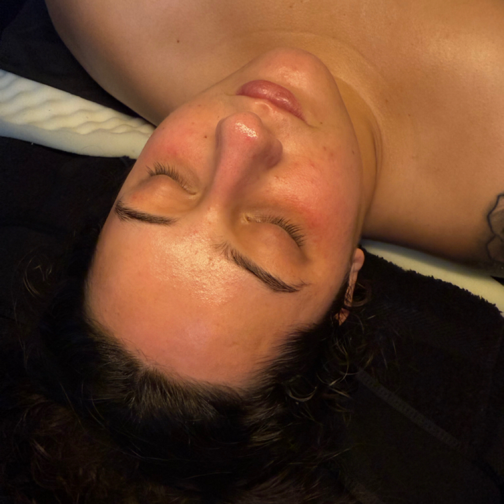 Chemical Peel at SereniMari Esthetics in Toledo, OH