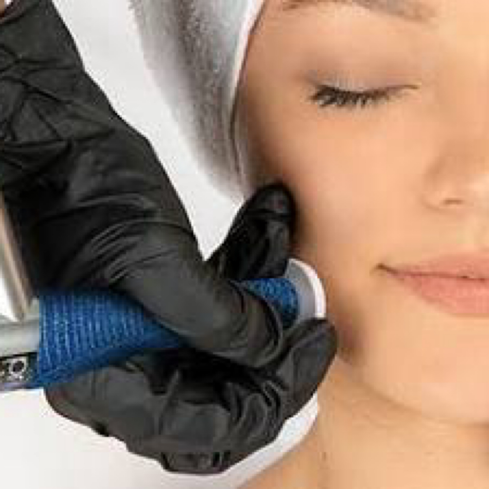 PROCELL Microchanneling at Madi Coca Aesthetics At The Skin Refinery in Nicholasville, KY