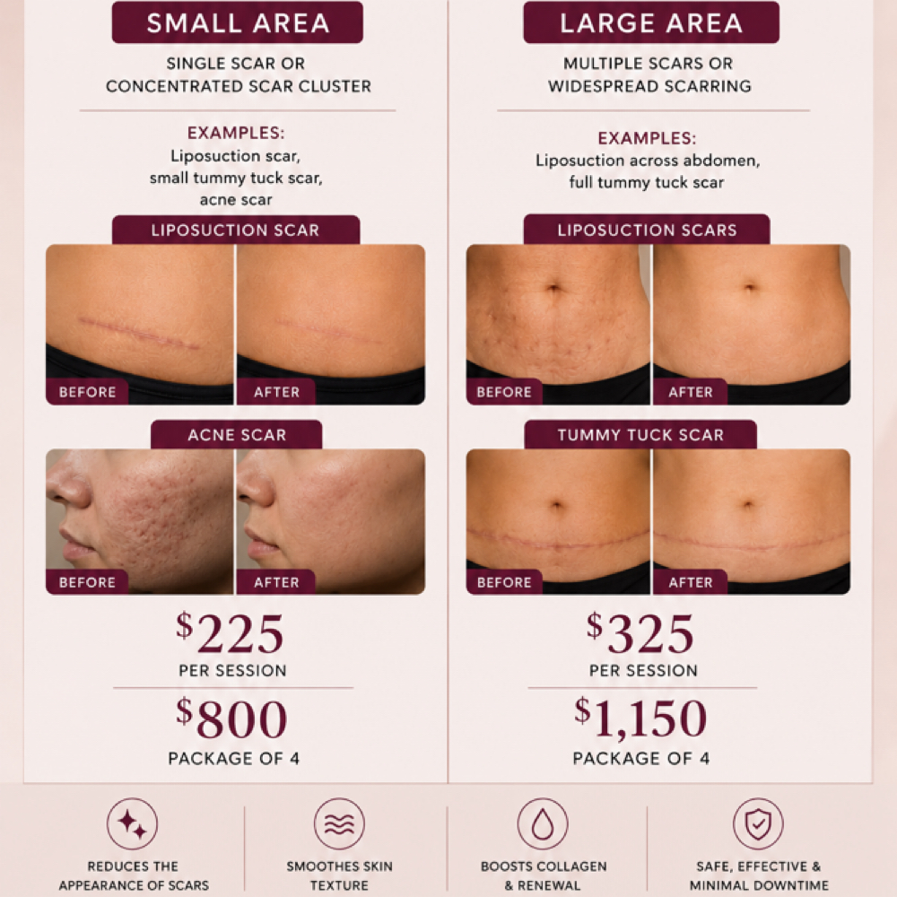 PRX C Small Area Scar Treatment at Pattyb Wellness in Bellmore, NY