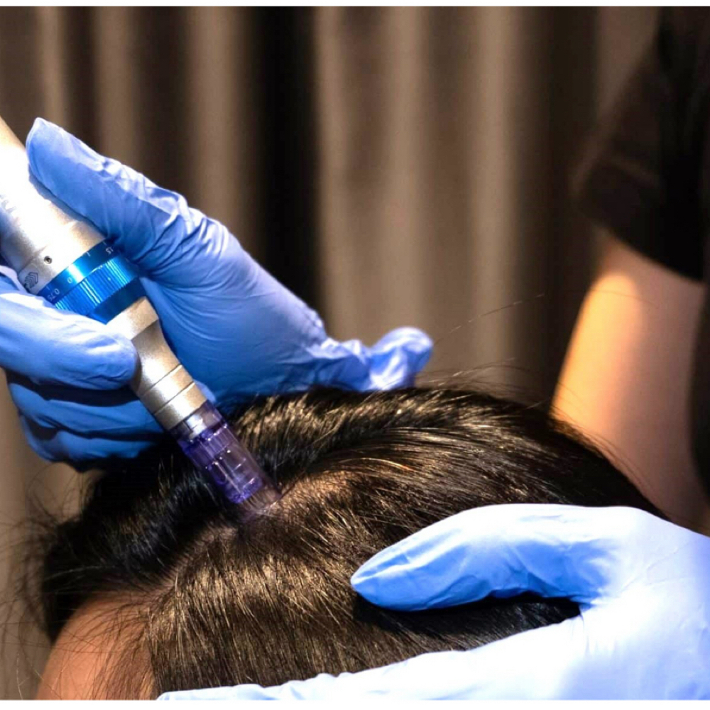 Regenerating, scalp micro needling at Devi Studio in Surprise, AZ