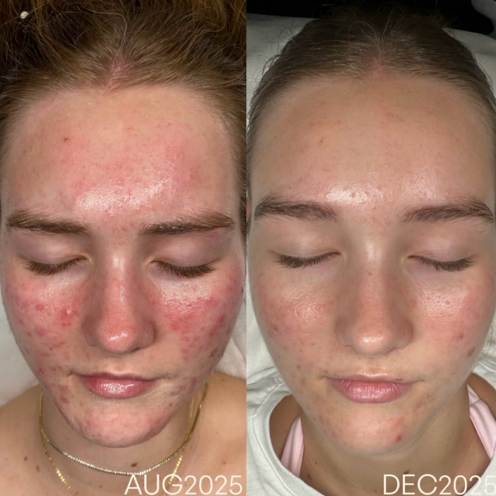 Skin Transformation Bootcamp