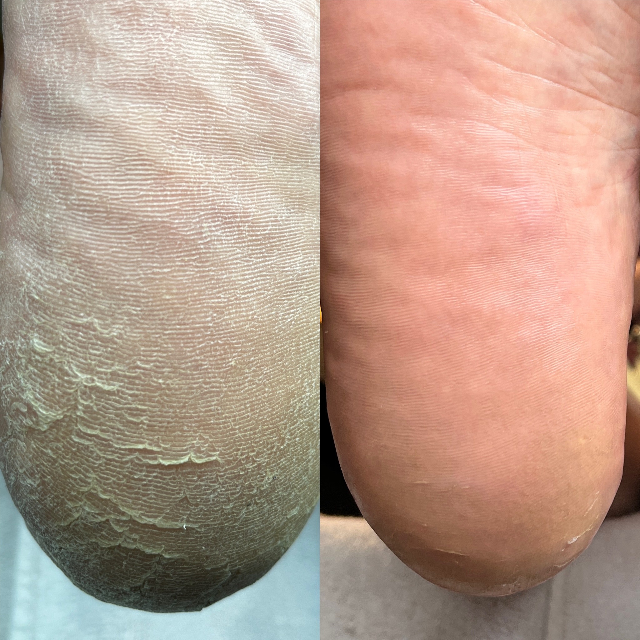 Vital Wellness Waterless Pedi at Olivine Natural Salon & Spa in Spokane, WA