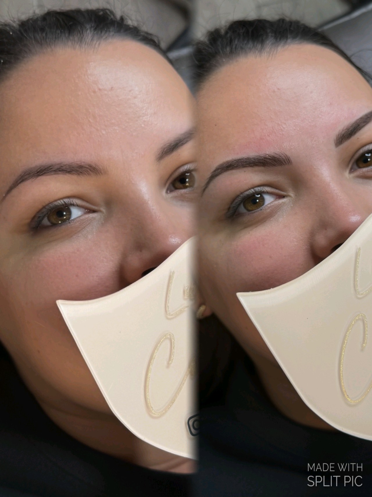 Combination Brow