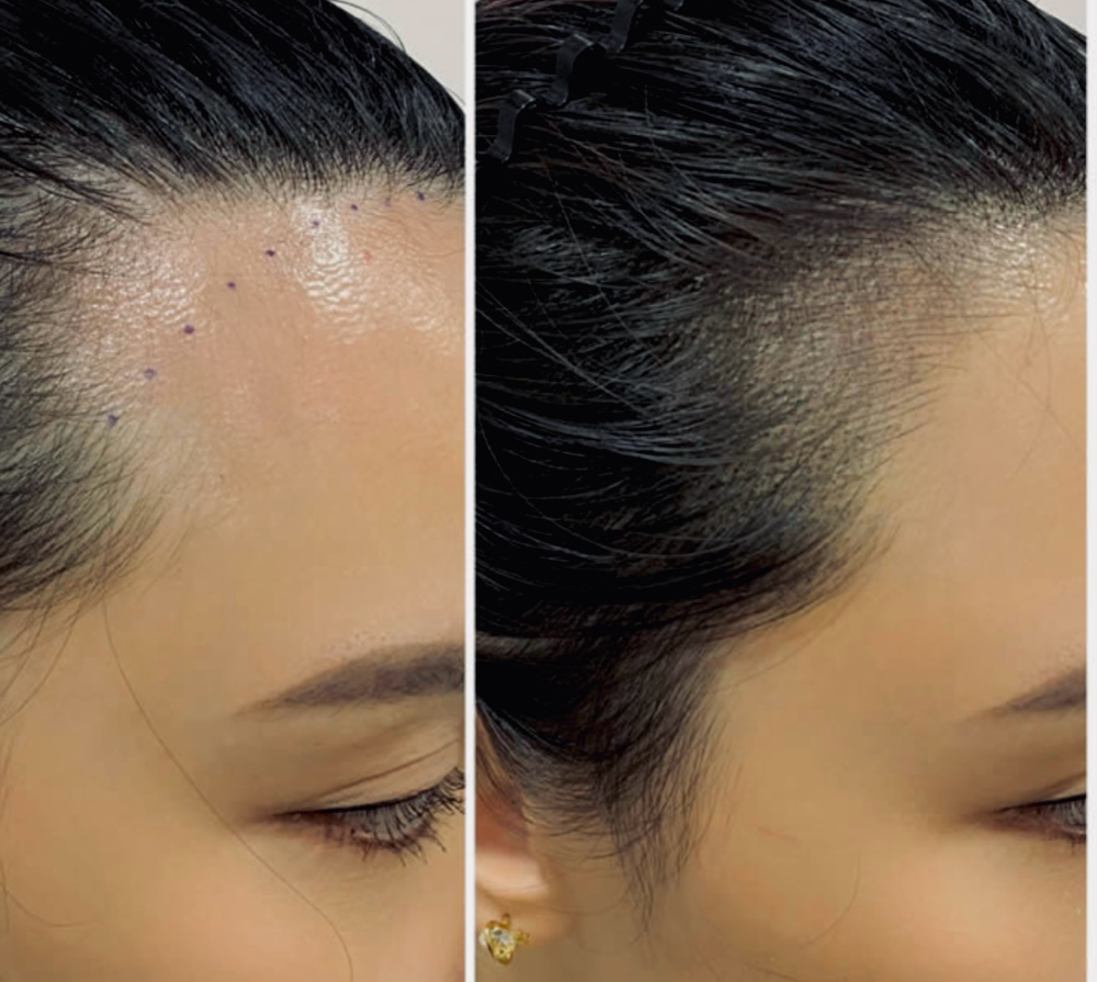 Hairline Tattoo