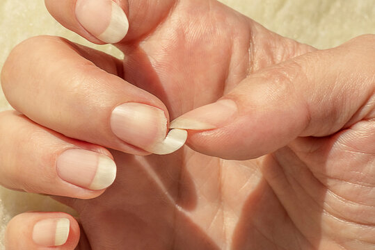 Broken Nail