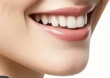 Chin