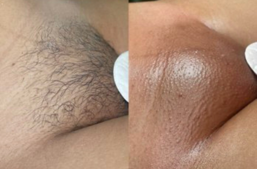 Brazillian For Women