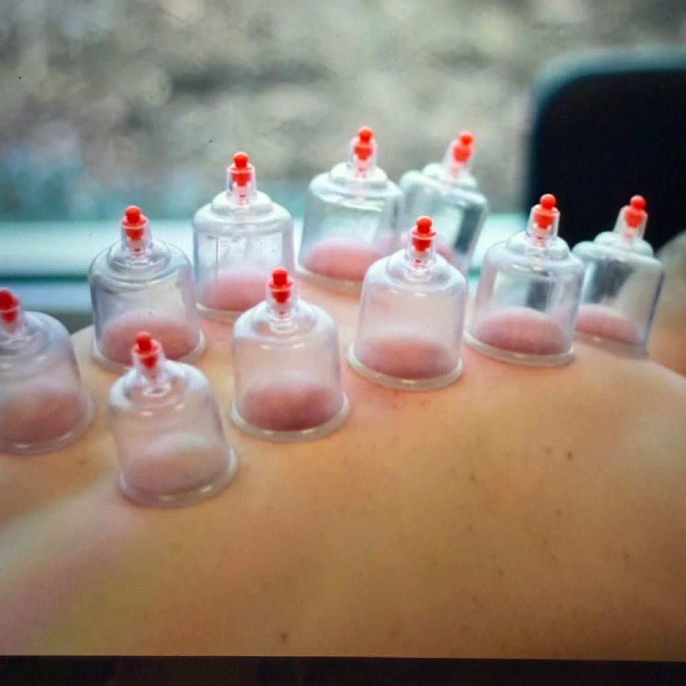 Cupping Therapy at Narine’s Nails & Esthetics LLC in Carmel, IN