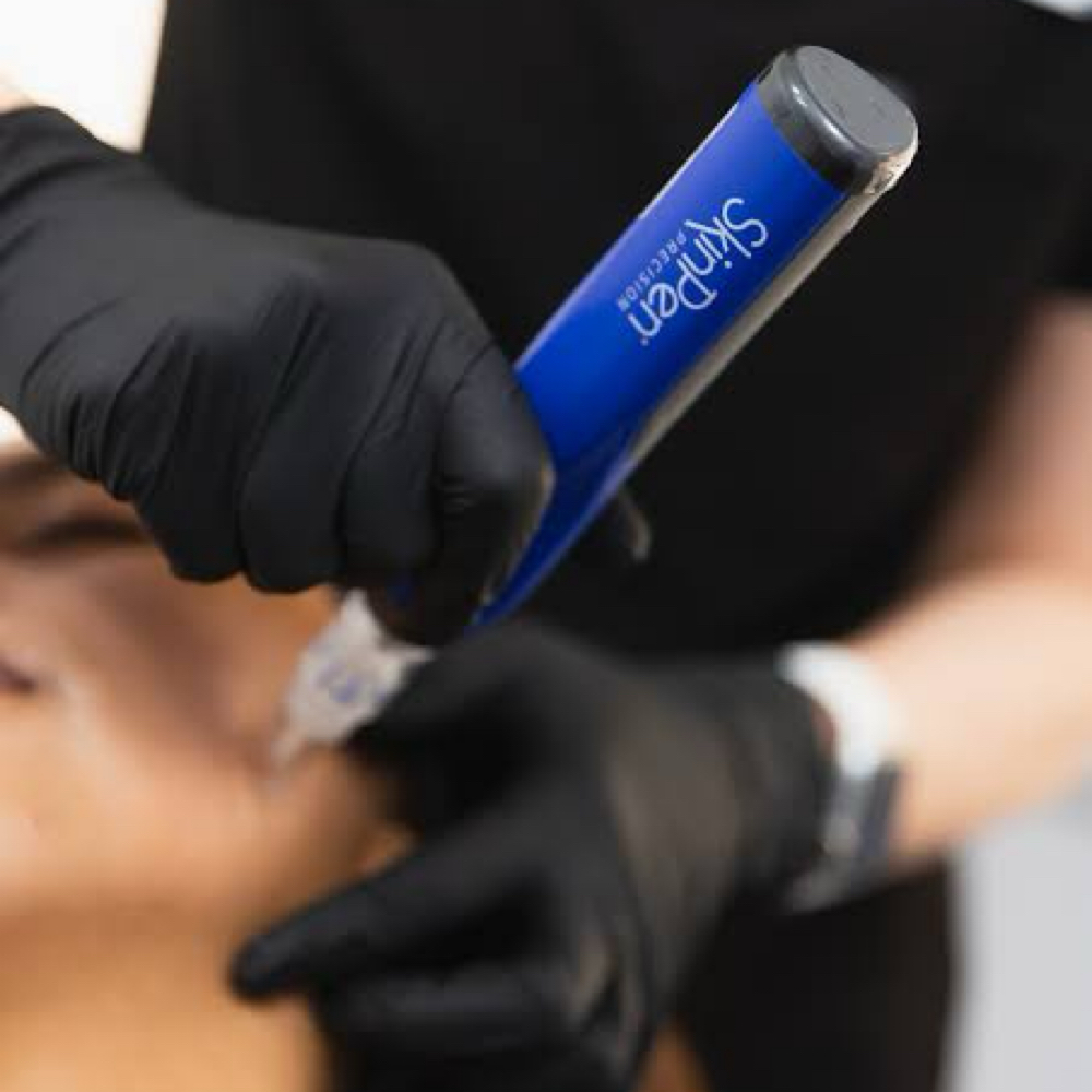SkinPen (Collagen Induction)