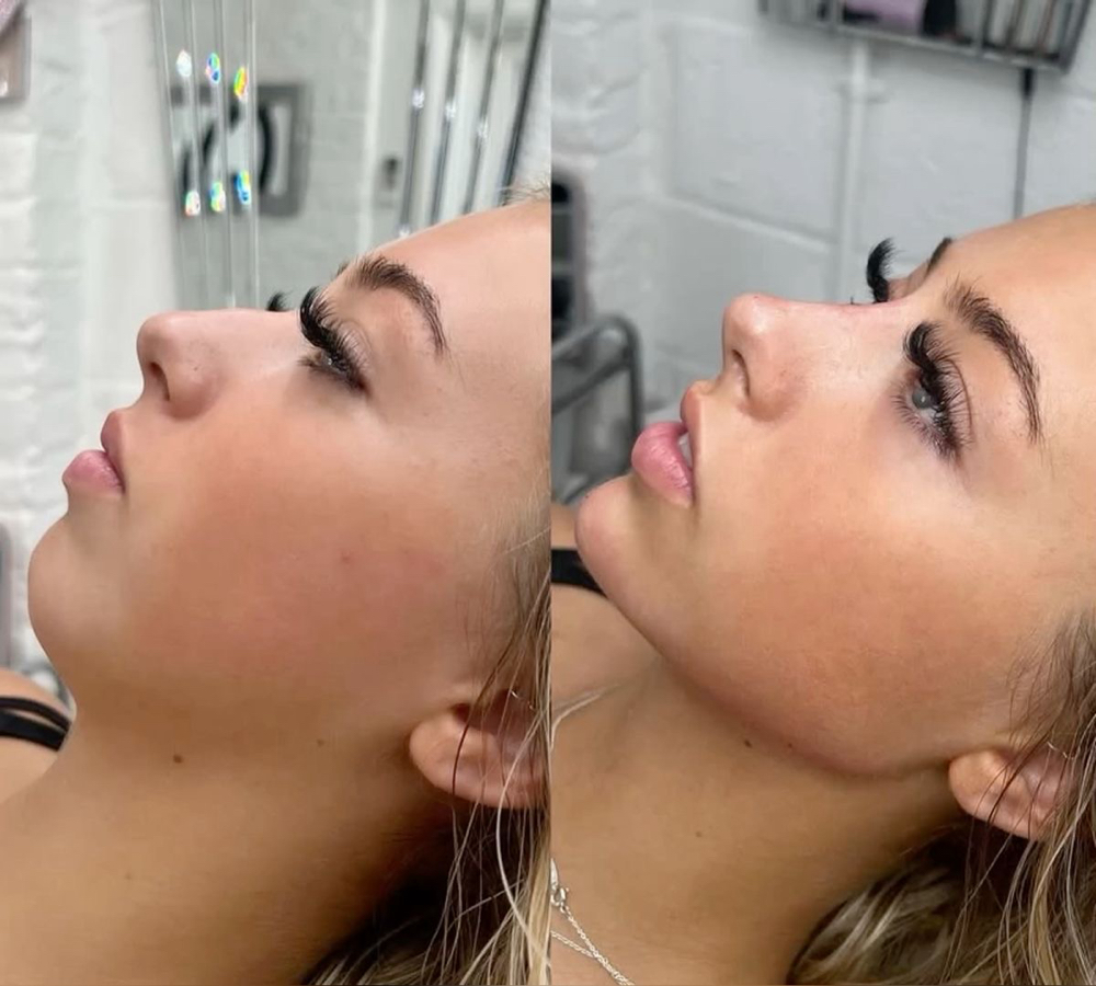FULL FACE / ARMONIA FACIAL at Sashy Beauty Studio in Carolina, PR